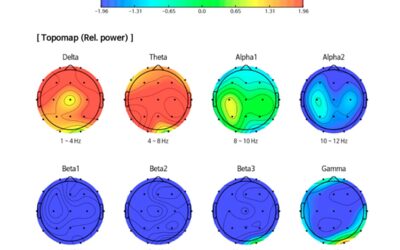 How to interpret qEEG results?